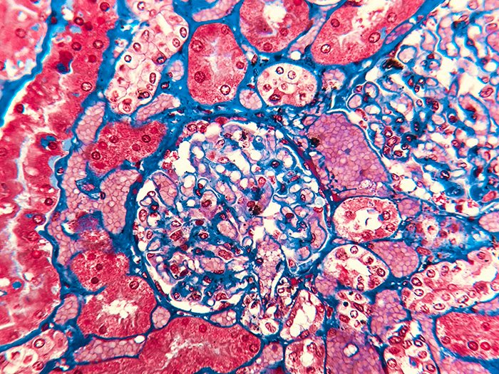 Trichrome An image of a section stained with Trichrome